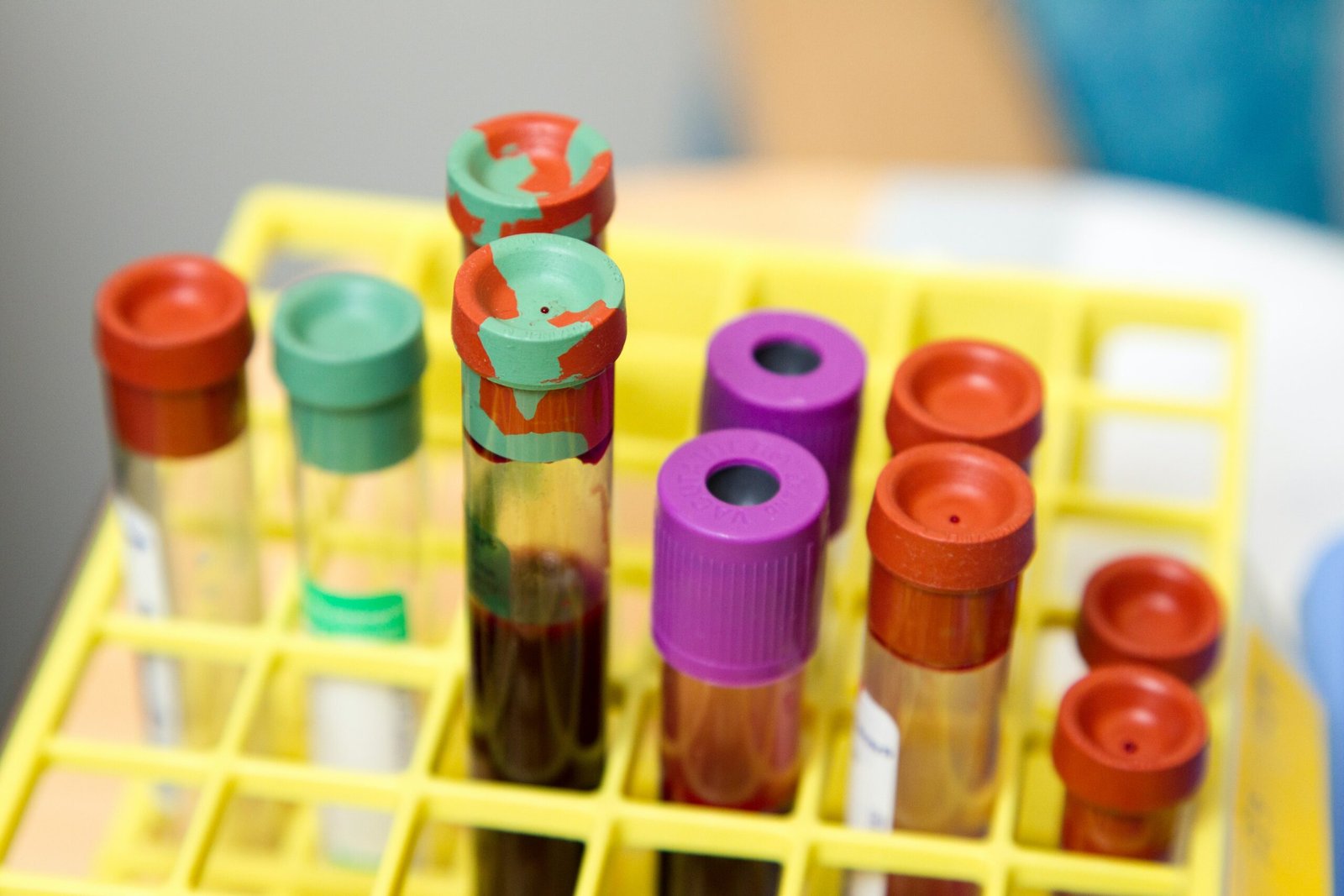 Vials of blood with multicolored tops sit in a yellow plastic holder waiting to be tested